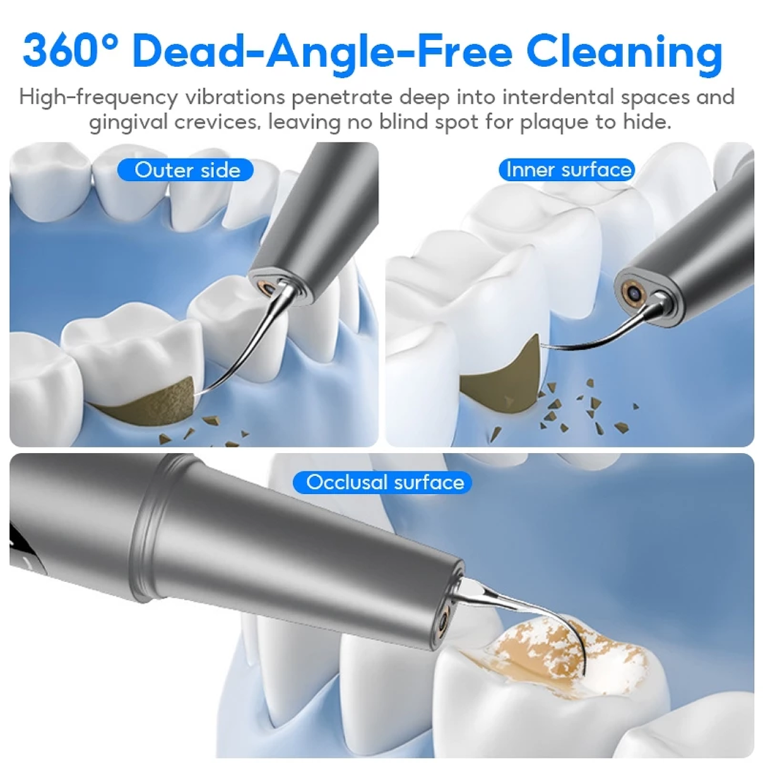 Smiley - Ultrasonic Dental Scaler with 360° Camera *Pre-Order Exclusive Discount*